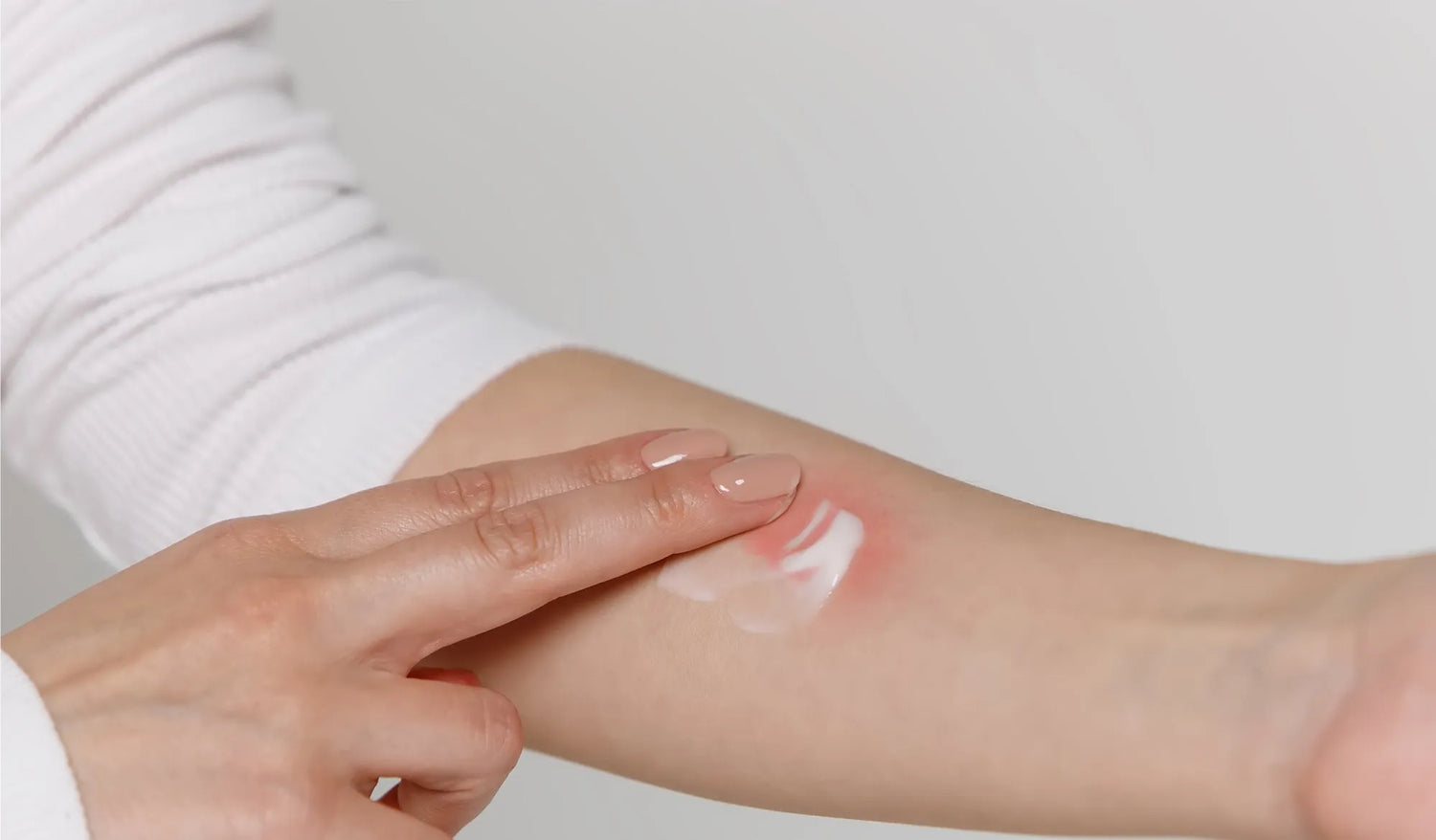 Alfacort Cream: Fast Treatment for Skin Infections