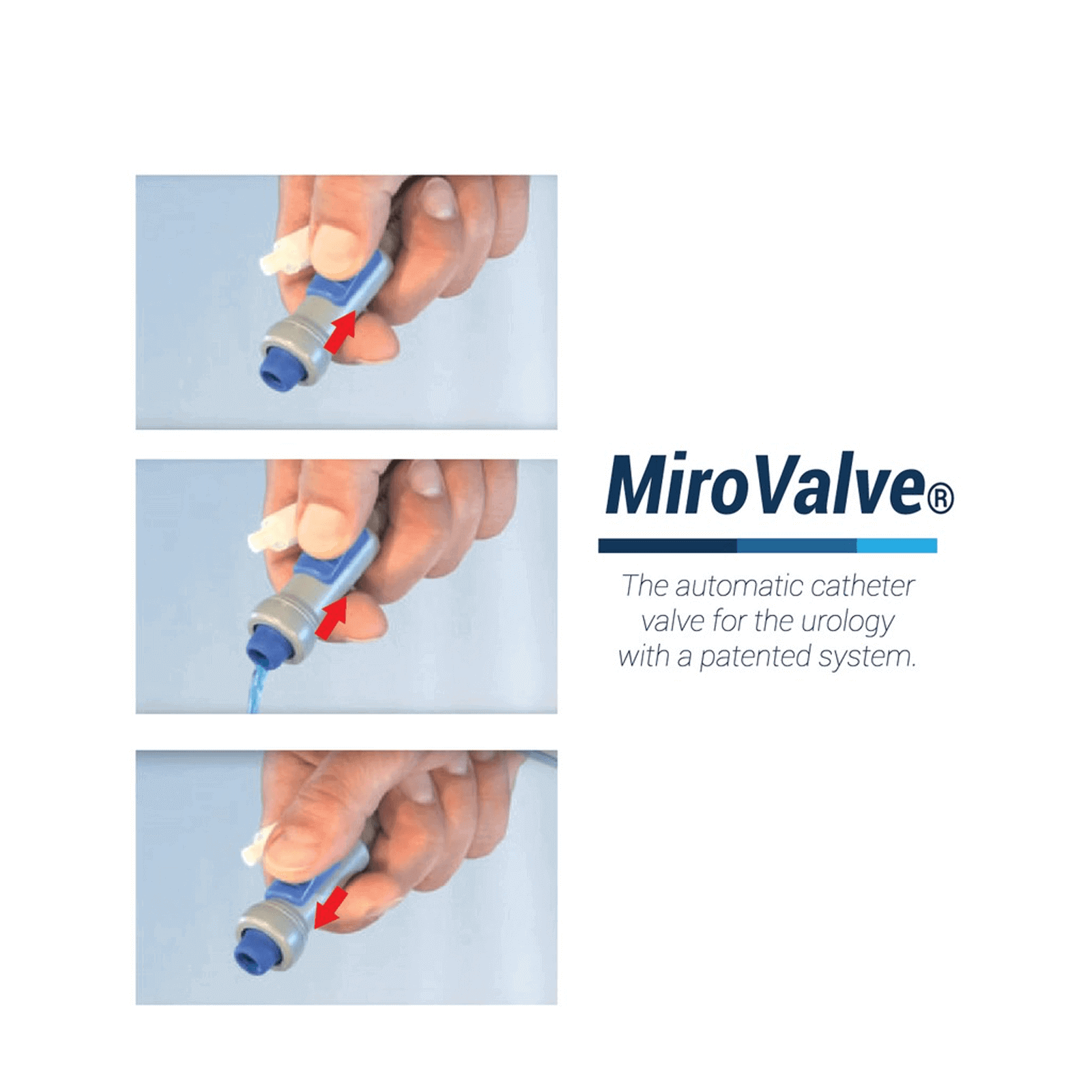 ميرو صمام معقم أوتوماتيكي لجراحة المسالك البولية 3101   